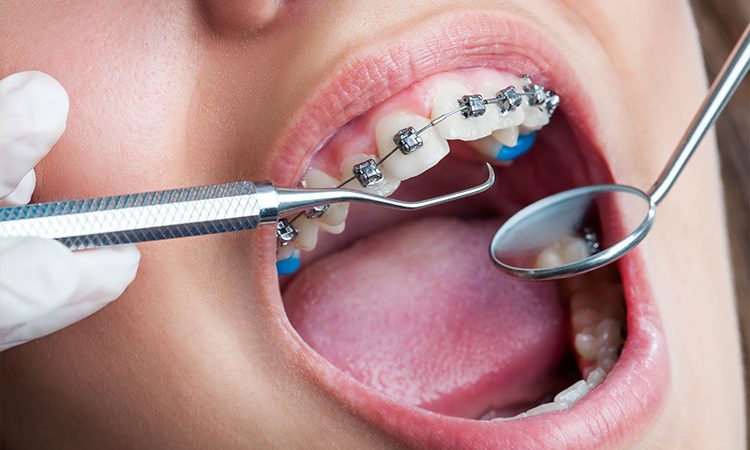 Clínica Atenta Odontologia Sistêmica - Ortodontia