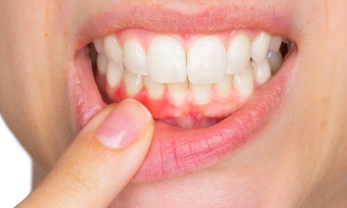 Clínica Atenta Odontologia Sistêmica - Periodontia